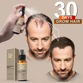 PURC 30ml Plaukų lakas, Plaukų Augimo Produktai Plaukų Augimą, Eteriniai Aliejai, Stabdžių Plaukų Slinkimas, Imbieras Plaukų Augimą Remonto Vyrams - 